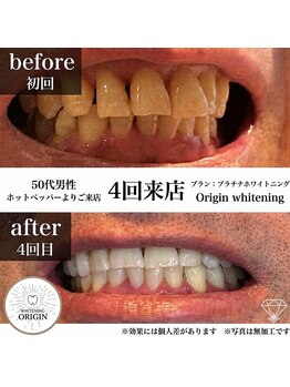 オリジン 大分王子店(origin)の写真/【大分駅車で6分】隙間時間、何かのついでに通いやすい♪お手軽価格でセルフホワイトニングが初めての方に