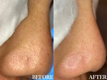 サロン ムスブ(salon MUSUBU)/山梨エステ/甲府エステ