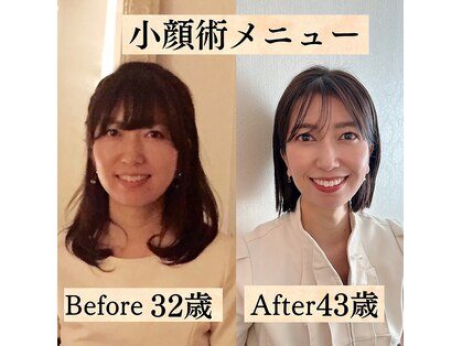 パルフェット(parfaite)の写真