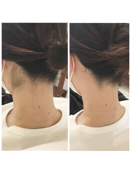 グロー アイラッシュアンドネイル(Glow)/うなじ、襟足のワックス脱毛