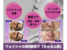 ヒダマリ(HIDAMARI)の雰囲気（信頼のMADE IN JAPANの商材と技術で痛みの少ない｢眠れるWAX脱毛｣）