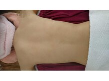 サロンエム(Salon m)/ブライダル体験　背中エステ