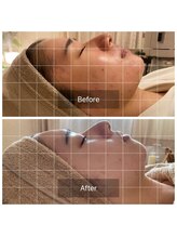 サロン ド オーブ(Salon de Orb)/凸凹、赤み、ニキビケア◎