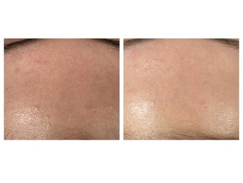 ヴィテラス バイ アリア(Veteras by aria)/☆艶肌で手に入る☆