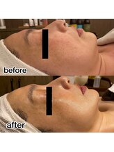 ロカヒ(Lokahi)/ビフォーアフター