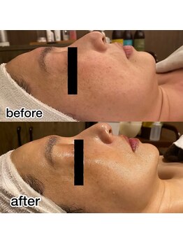 ロカヒ(Lokahi)/ビフォーアフター