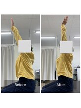 ナオル整体 大里院(NAORU整体)/40代女性　長時間座るのが辛い