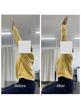 ナオル整体 大里院(NAORU整体)/40代女性 長時間座るのが辛い