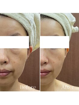 メイス 福井店(MEIS)/お客様Before、After