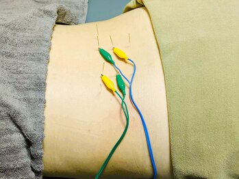 パウズ(Paws)/鍼×鍼電気施術 〈西葛西駅〉