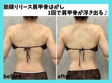 マーブル/筋膜リリース肩甲骨はがし