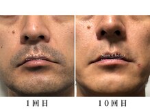 モンシェリ 広島店(Mon Cheri)