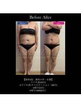 トータルクリア(TOTAL CLEAR)/SecretMes痩身