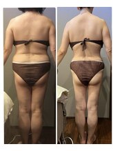 ムーン 高崎店(MOON)/痩身エステ50代