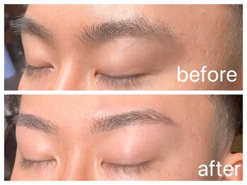 クラシックス(CLASSICS)/wax脱毛