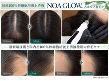 フロウ(Flow)の雰囲気（国内初！100%幹細胞培養上清液と最新マシンノアグロウで育毛促進）