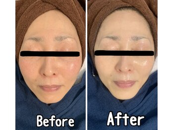 ブランシュール/エンビロンフルコース