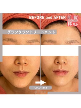 アンナカルナ(AnnaCarna)/グランタラソトリートメント写真