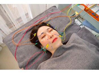 ココ(Coco)/美容鍼の施術