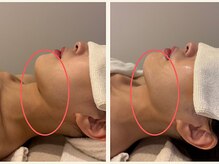 カド 白金台(Kado)/高評価◆DTケア/インディバ