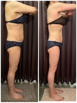 ビーシェイプ 君津(B-Shape)/【痩身】ビフォーアフター