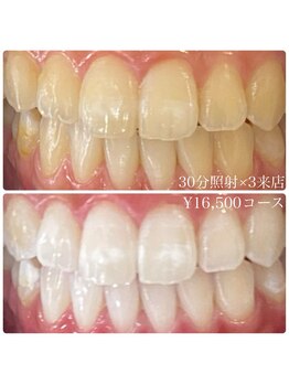 ホワイトニングルーム 横浜店(Whitening Room)/セルフホワイトニング/横浜