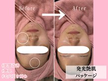 エンクリニカルラボ 京都駅前店(E&N CLINICAL LABO)/発光艶肌パッケージ☆