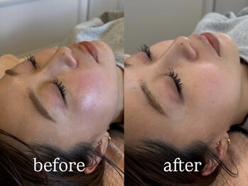 リコ ヘアアンドリラクゼーション(LICO)/モデリングパック