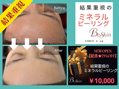 ビースキン 広島(BE:SKIN)の写真