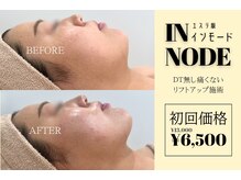 アルフォービューティー 広島店(ALU for beauty)