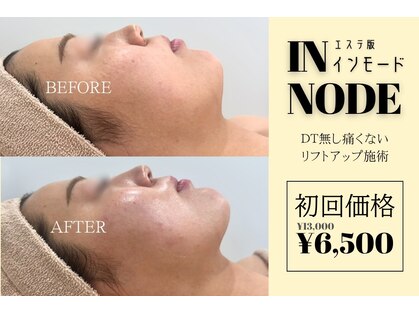 アルフォービューティー 広島店(ALU for beauty)の写真