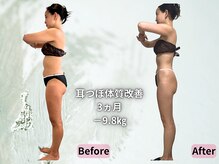 ポノ 茅ヶ崎(Pono.)/耳つぼ体質改善でサイズダウン◎