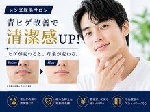 ネクストプラス 梅田店(NEXT+)/青ヒゲ改善メンズ脱毛