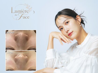 ルミエール ド ファス 品川(Lumiere de Face)の写真