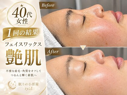 ティア(tyiA)の写真
