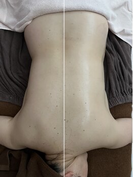 アリュール(Allure)/骨盤調整コルギ（５０代女性）