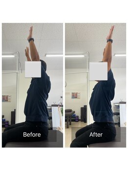 ナオル整体 大里院(NAORU整体)/30代男性 デスクワークが辛い