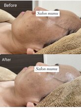 ムム(mumu)/シミ・シワ改善！