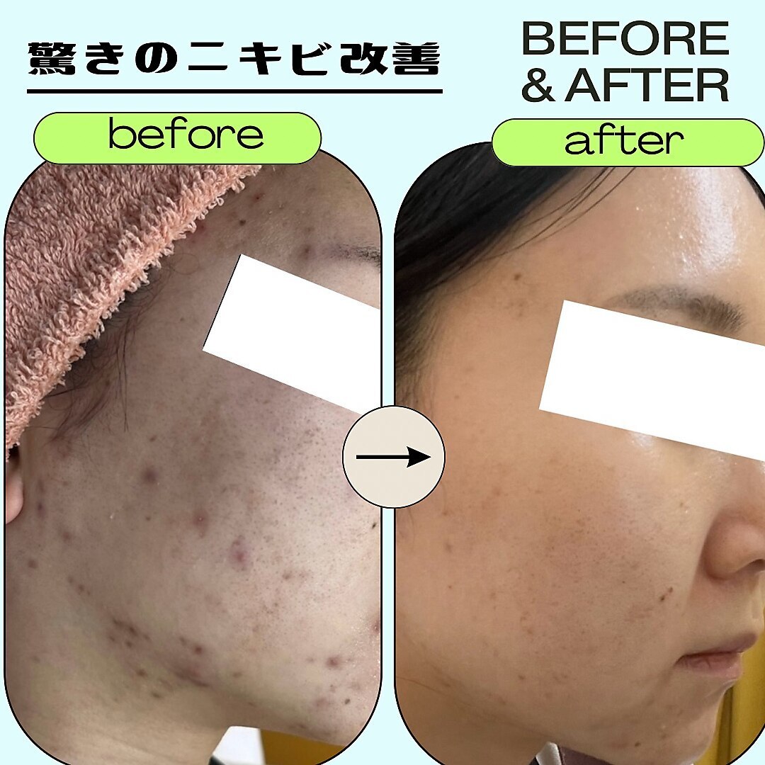 パールプラス美容セット売り パールプラス 可児店(Pearl plus)｜ホットペッパービューティー