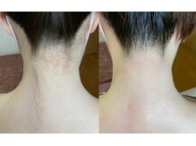 ティンク(Tink)/うなじワックス☆Before→After