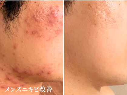 アクール(Accueil)の写真