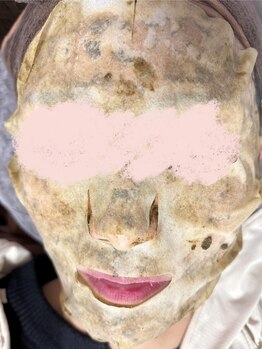 サロン ド ミコラ(salon de Micora)/【ハーブピーリングパック中】