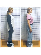 幸鍼灸整体院 武庫之荘院/整体・トレーニング・姿勢変化12