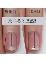 プライベートネイルサロン ママネイル(mamanail)/最強のネイルケア