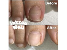 インクズーネイル(INKZOO NAIL)の雰囲気（BSブレイスによる巻爪改善メニューも有ます。）