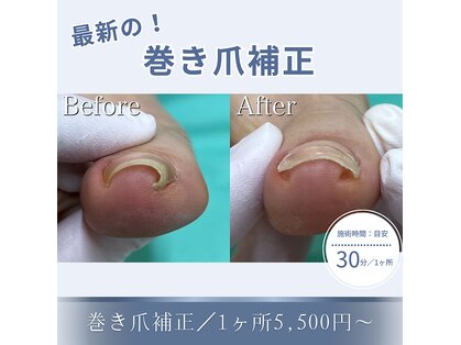 巻き爪補正店 札幌店の写真