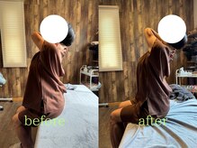 アポヨ鍼灸院(APOYO鍼灸院)/鍼整体　before/after