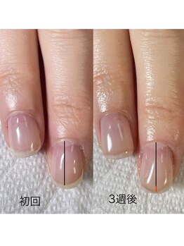 シュシュ(shou shou)/自爪育成