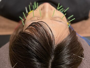 アップサポート(up support)