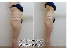 コスメ デ グレース(cosme de greace)の雰囲気(最新痩身マシン&ゴッドハンドでスリムなボディに導きます!)